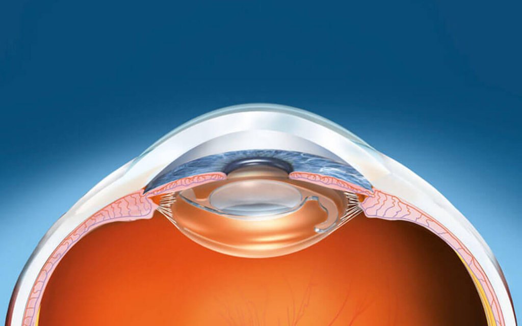 Auf was Sie als Kunde bei der Wahl der Kurzsichtig kontaktlinsen achten sollten